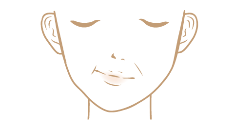 顎変形症（顔面の変形）の顔面