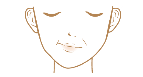 顎変形症（顔面の変形）の顔面