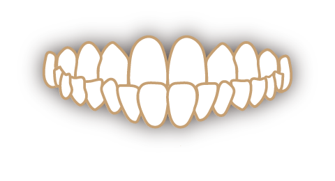 受け口（下顎前突・反対咬合）の歯並び