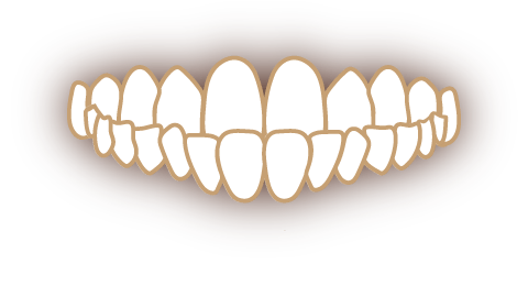 受け口（下顎前突・反対咬合）の歯並び
