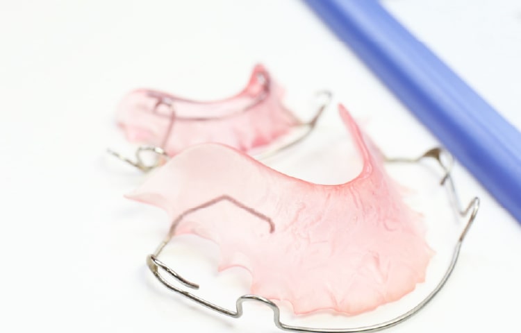 大阪の矯正歯科 淀屋橋矯正歯科 小児矯正で歯が移動する仕組み